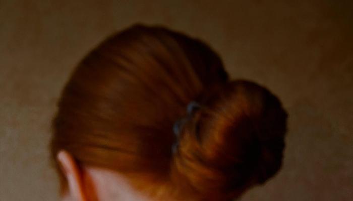 Understanding Acne: Decoding Pimple Mysteries